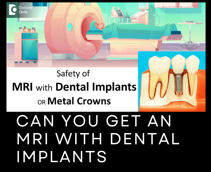 Can You Get an MRI with Dental Implants (1)